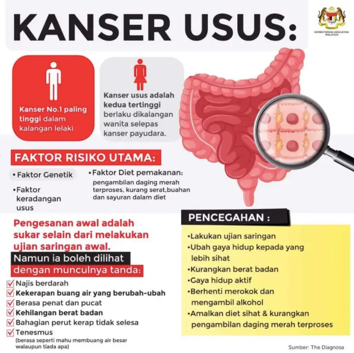 kanser-usus.webp
